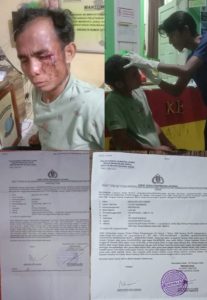 Korban Mencari Hati Giawa melaporkan kasus dugaan tindak pidana pengeroyokan secara bersama-sama di Polsek Muara Batang Gadis, Polres Mandailing Natal, belum mendapatkan kepastian hukum hingga saat ini.